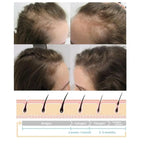 Nourishes Hair Roots Vortex Comb Bundle 4 Settings High Frequency Vortex Hair Growth Wand Easy to Use Facial Machine Hair Care