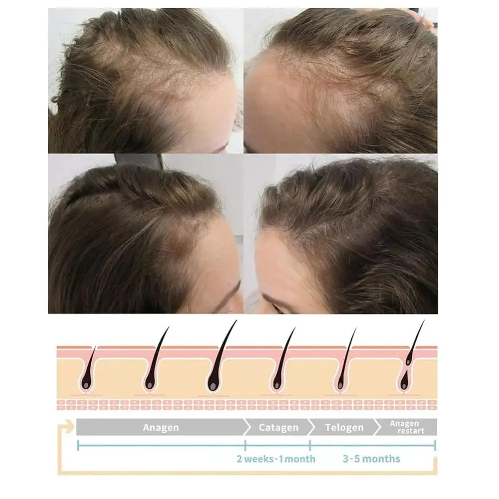 Nourishes Hair Roots Vortex Comb Bundle 4 Settings High Frequency Vortex Hair Growth Wand Easy to Use Facial Machine Hair Care